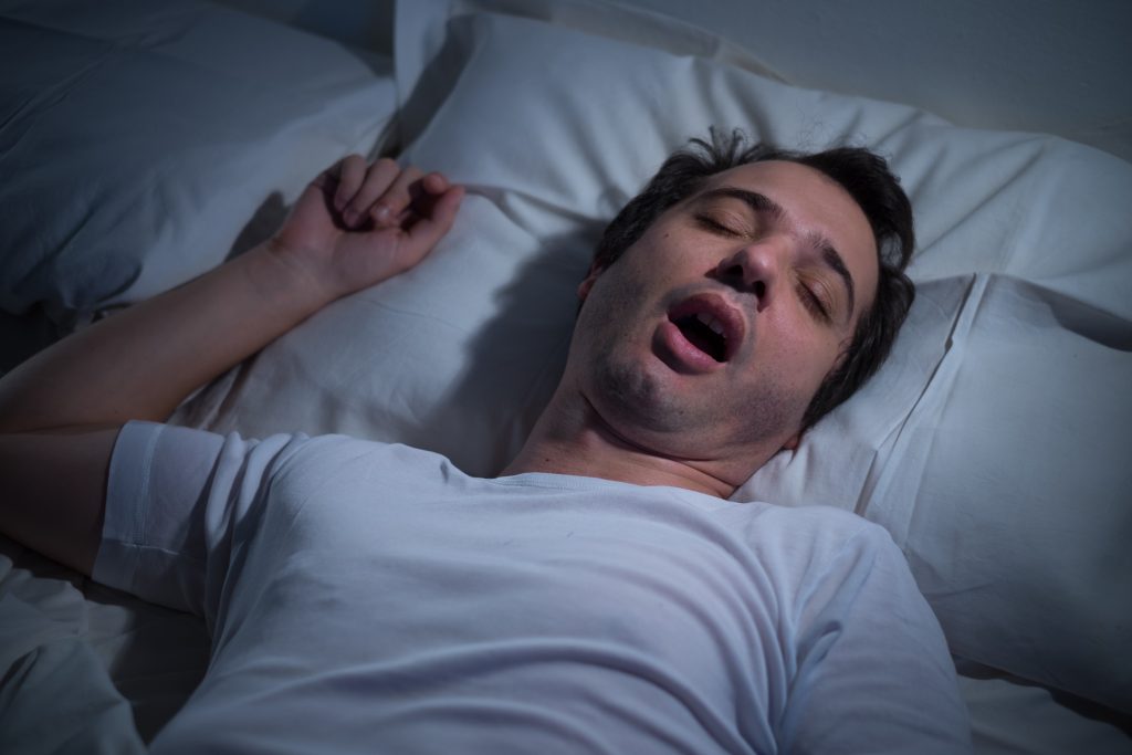 Mouth Breathing