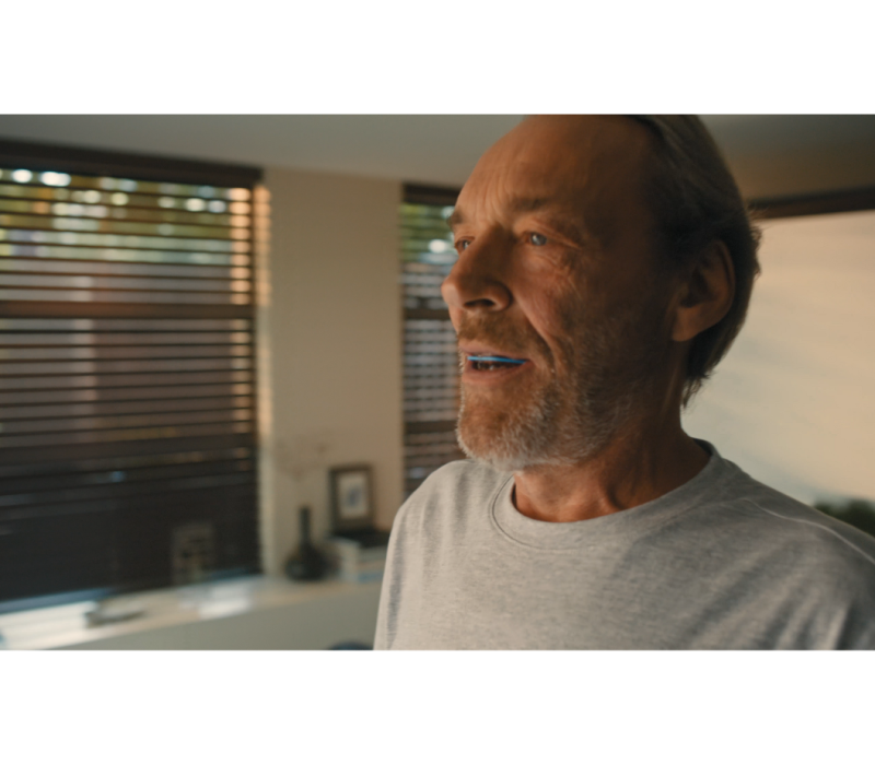 Mies käyttää SomnoDent Avant -laitetta, joka on tarkoitettu uniapnean hoitoon SomnoMedin avulla.