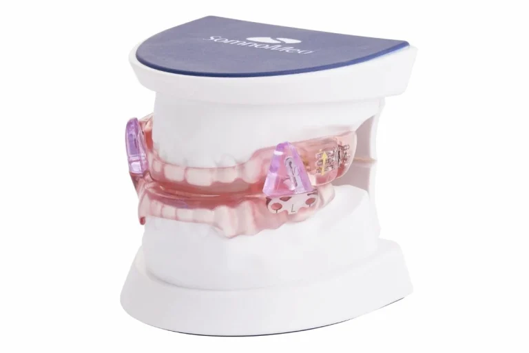 SomnoDent-Fusion-with-typodont-angle-product-image.jpg