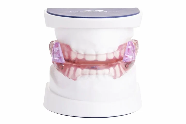 SomnoDent-Fusion-with-typodont-front-product-image.jpg